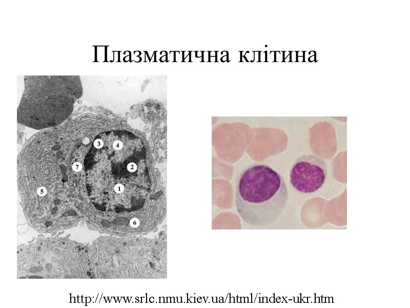 Плазматична клітина http://www.srlc.nmu.kiev.ua/html/index-ukr.htm